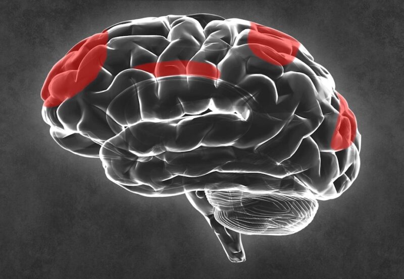 ADHD forstyrrer hjernens netværk