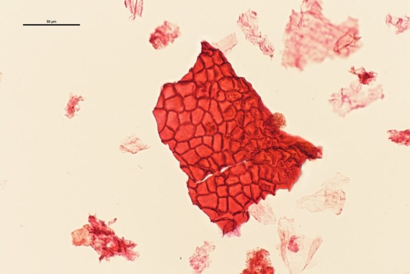 Mikroskopbillede af celleform i fossilt blad