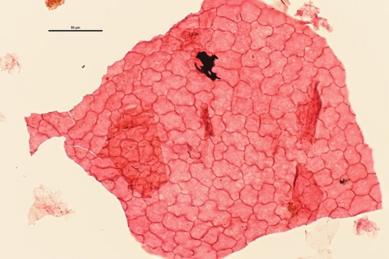 Mikroskopbillede af celleform i fossilt blad