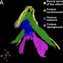 Et farvekodet anatomisk 3D-billede viser de dorsale nerver i klitoris (gul), corpus cavernosum (grøn), det venøse netværk (blå) og corpus spongiosum (pink) med en retningsbestemt akse nederst til venstre.