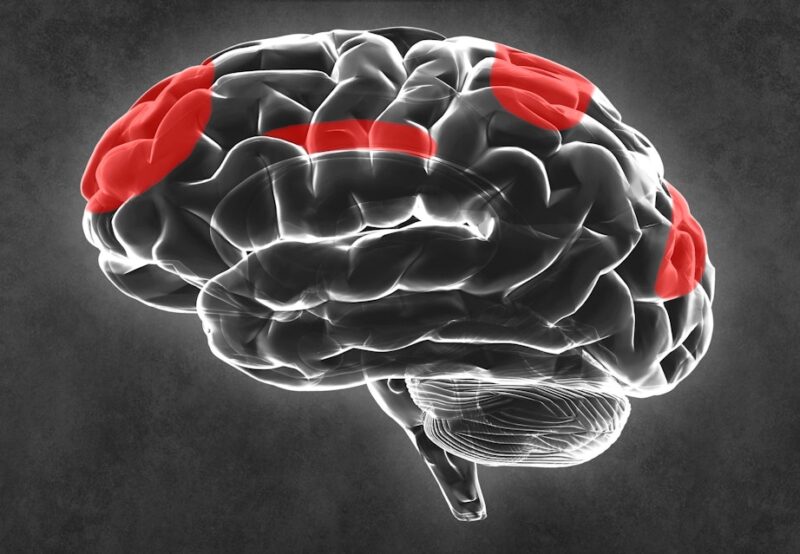 ADHD forstyrrer hjernens netværk